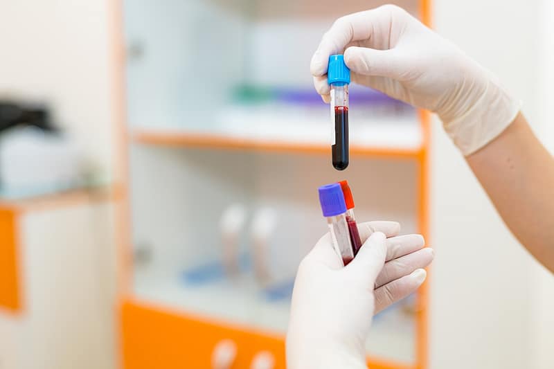 Médico con probeta con sangre