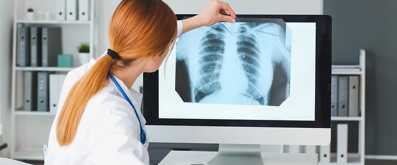 nowa terapia rak płuca Amgen